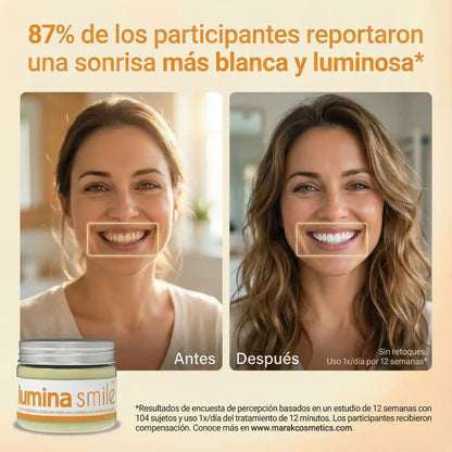 Lumina Smile: Blanquea sin dolor — especial para dientes sensibles