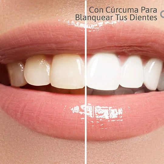 Lumina Smile: Blanquea sin dolor — especial para dientes sensibles