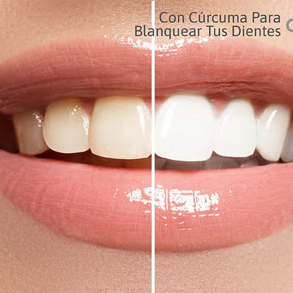 Lumina Smile: Blanquea sin dolor — especial para dientes sensibles
